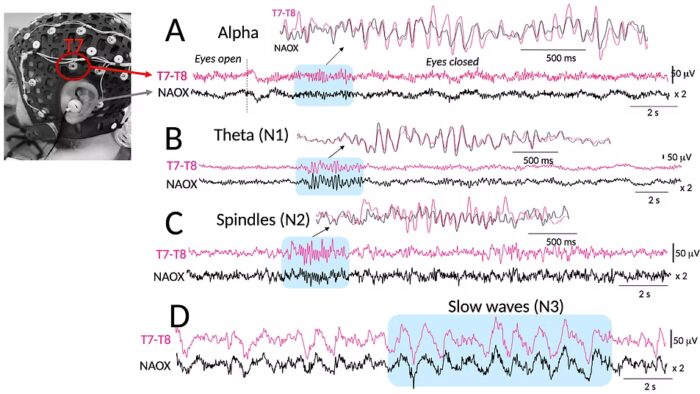 figure (1) tifpng 0x0x
